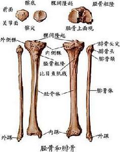 腓骨肌萎縮症說明圖