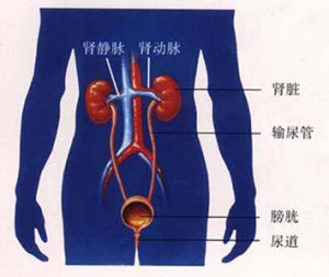 慢性膀胱炎