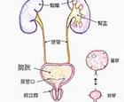 膀胱癌