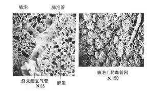 外源性變應性肺泡炎