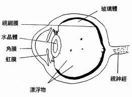 飛蚊症