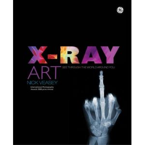 X-ray