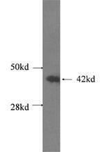 β-Actin