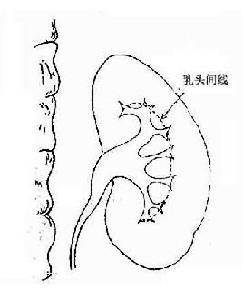 非特異性腎實質疾病