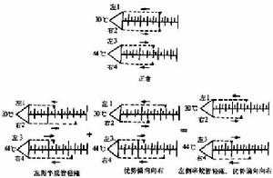 前庭功能檢查法