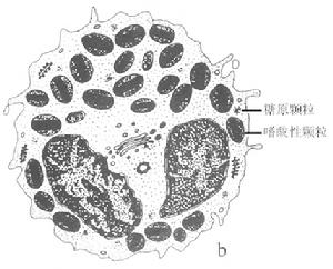 嗜酸粒細胞增多症