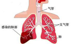 肺炎衣原體肺炎