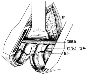 手術圖片