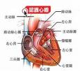 牛鏈球菌感染