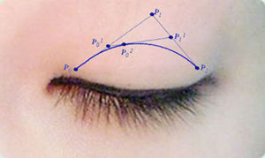 貝塞爾曲線雙眼皮