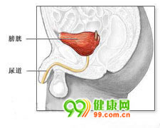 小兒後尿道瓣膜