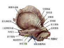 頜面部骨巨細胞瘤