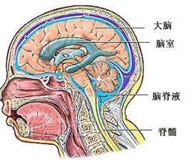 腔隙性腦梗塞後遺症