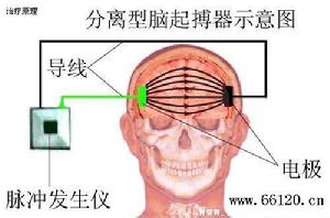 原理介紹