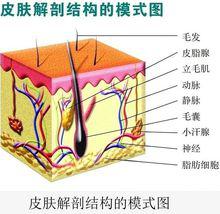 閉合性粉刺