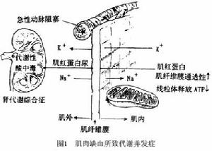 肌病腎病性代謝綜合徵