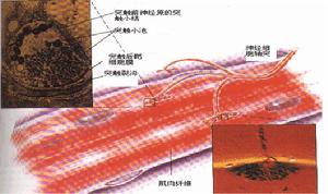 神經性肌強直