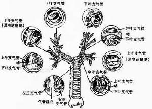 支氣管炎治療