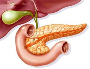 重症急性胰腺炎