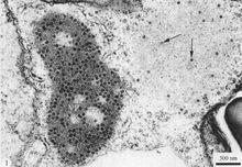 感染花椰菜花葉病毒的甘藍葉片細胞