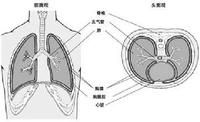 胸膜炎