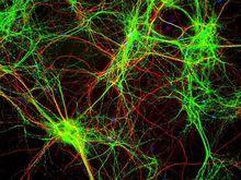 人造神經元