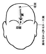 印堂的圖片