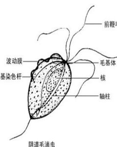 滴蟲性外陰炎