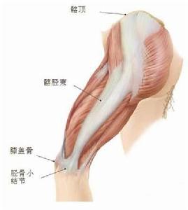 脛骨結節增高術