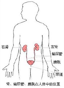 腎臟疾病伴發的精神障礙