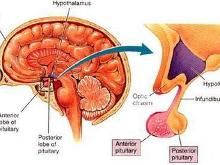 特發性低促性腺激素性性腺功能減退