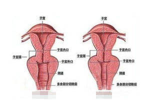 女性健康