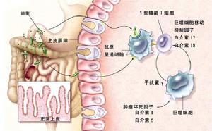 性病相關性胃腸道感染