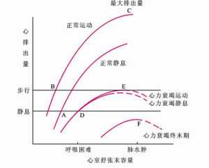 慢性心功能不全