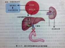 阻塞性黃疸發病機制