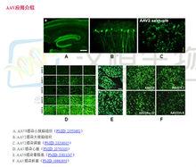 AAV感染不同組織效果圖