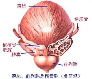 結核性膀胱自發破裂