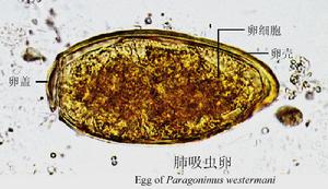 衛氏並殖吸蟲病
