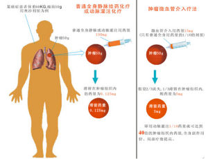 化療機理