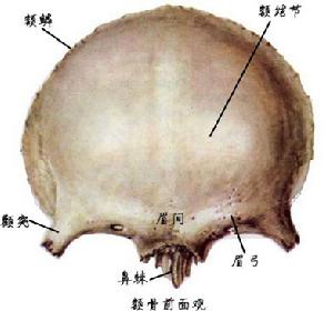 顱狹症