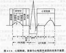 心電圖