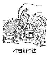 衝擊觸診法示意圖