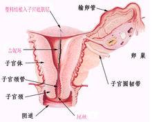 吉妮環放置位置圖