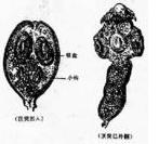 細粒棘球絛蟲病