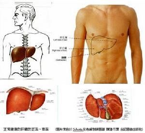 老年性肝炎 