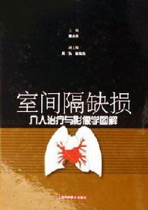 室間隔缺損介入治療與影像學圖解