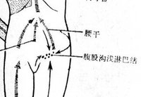 腹股溝淋巴結腫大