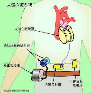 （圖）人造心臟工作原理