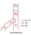 雙動脈式靜脈動脈化