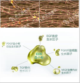 ST自體活細胞無痕植髮管理系統